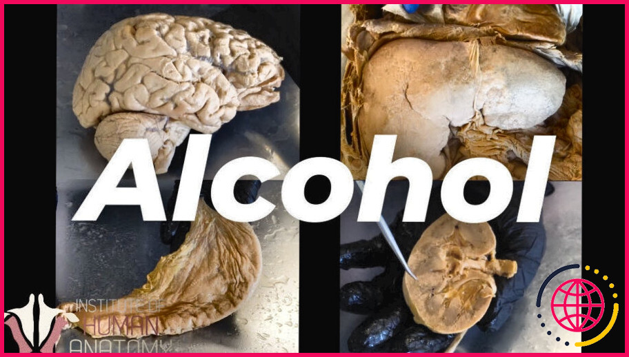 Comment l'alcool affecte-t-il l'hypothalamus et l'hypophyse ?
