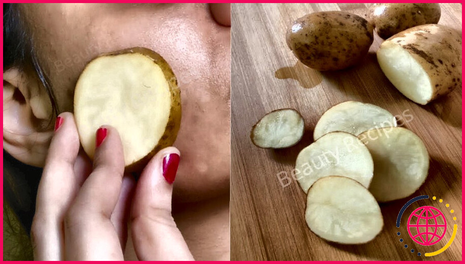 Comment les pommes de terre permettent-elles de se débarrasser des taches sombres ?
