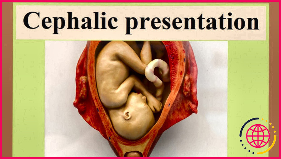 La présentation céphalique est-elle bonne pour un accouchement normal ?
