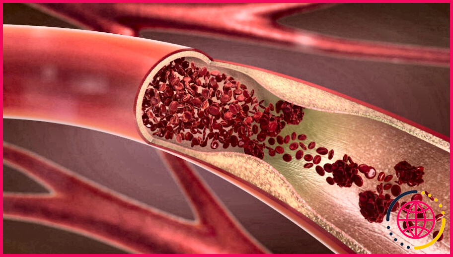 Pourquoi les artères doivent-elles être plus élastiques que les veines ?
