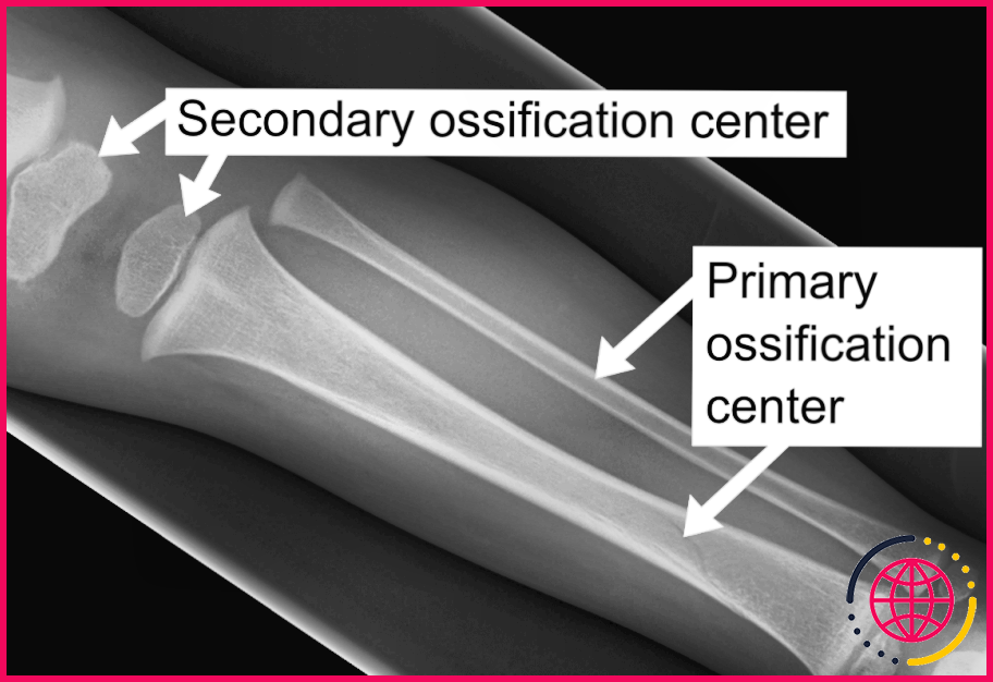 Quel est le processus d'ossification des os longs ?
