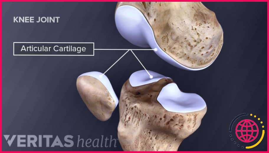 Quelle est la différence entre les 3 types de cartilage ?
