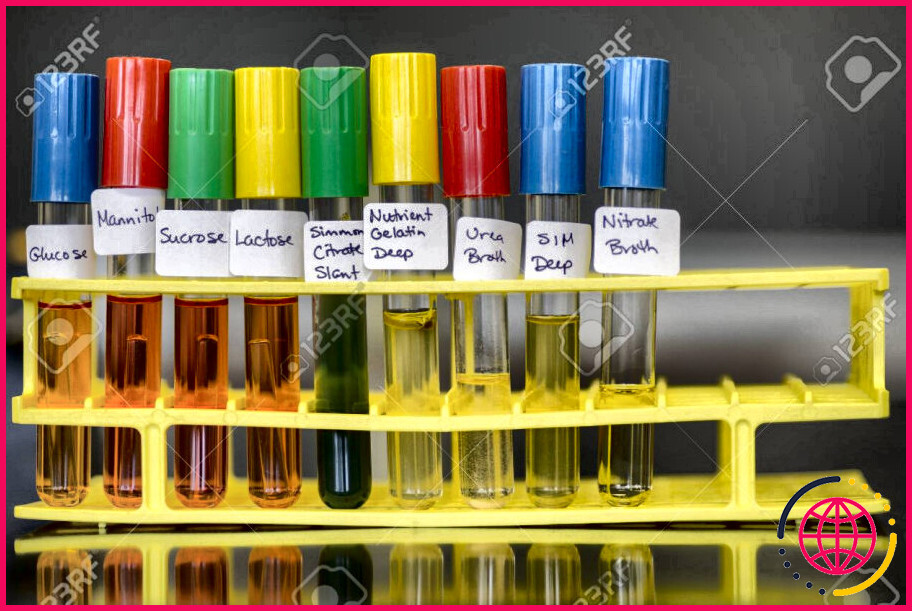 Quels sont les tests biochimiques d'identification des bactéries ?

