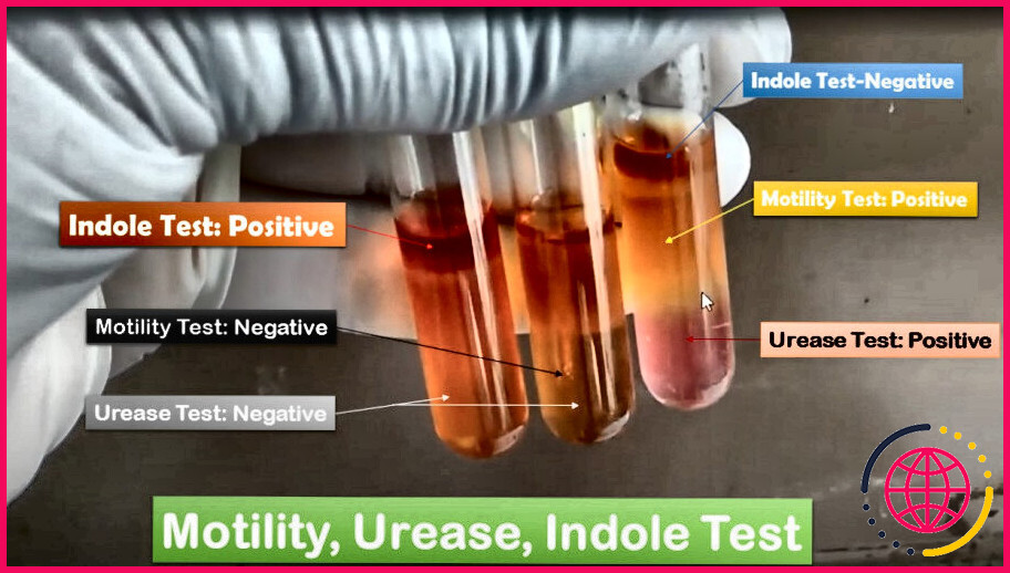 Comment le test à l'indole permet-il de différencier les bactéries ?
