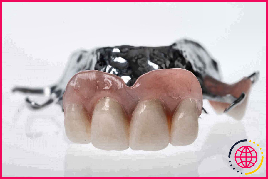 Comment nettoyer un dentier en chrome cobalt ?
