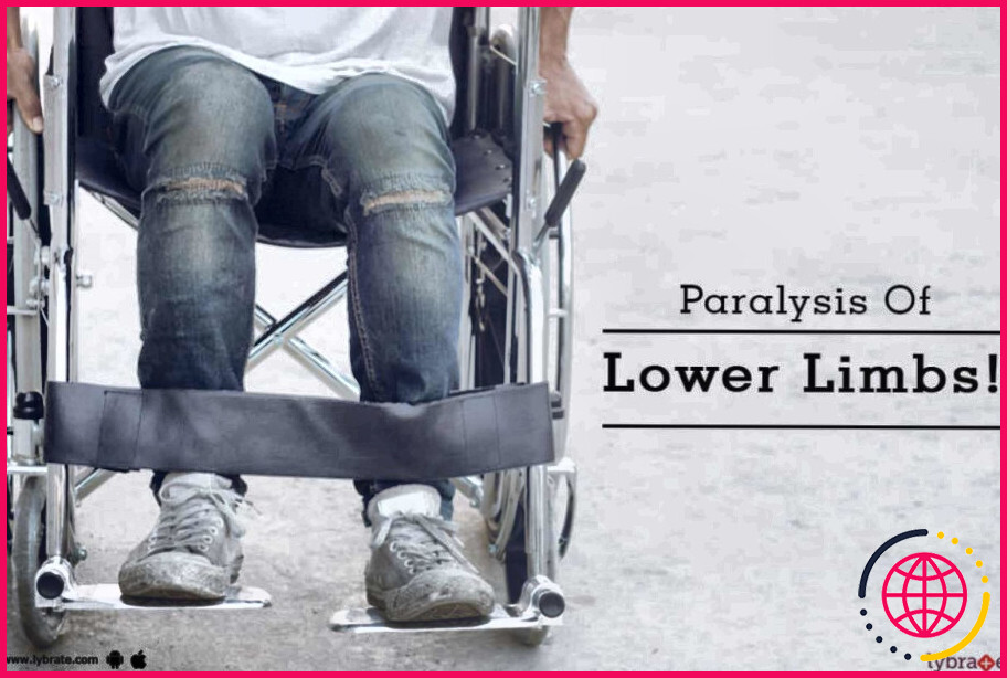 Qu'est-ce que la paralysie des membres inférieurs ?
