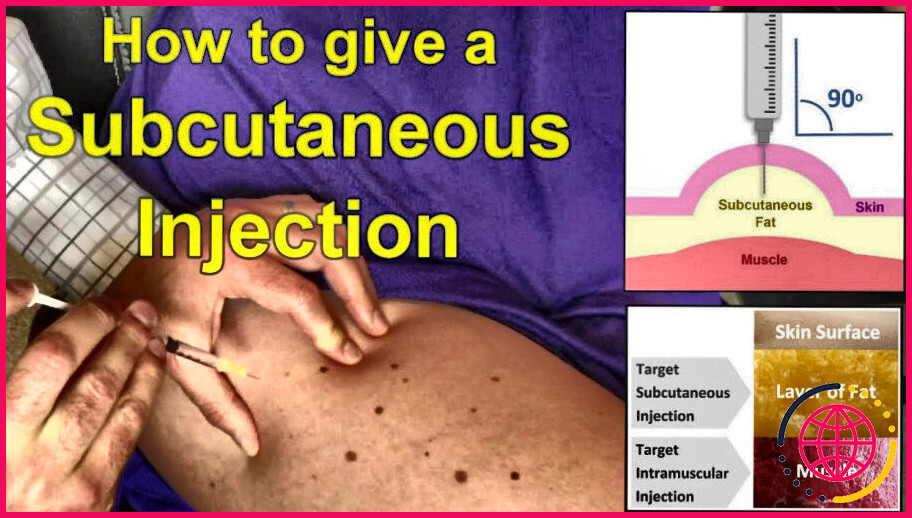Comment faire une injection sous-cutanée dans le bras ?

