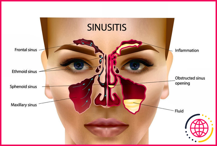 Que sont les sinus et où sont-ils situés ?
