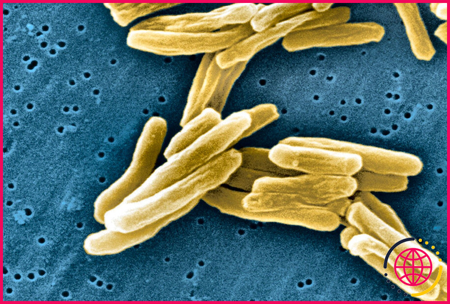 Quel type de bactérie est jaune ?
