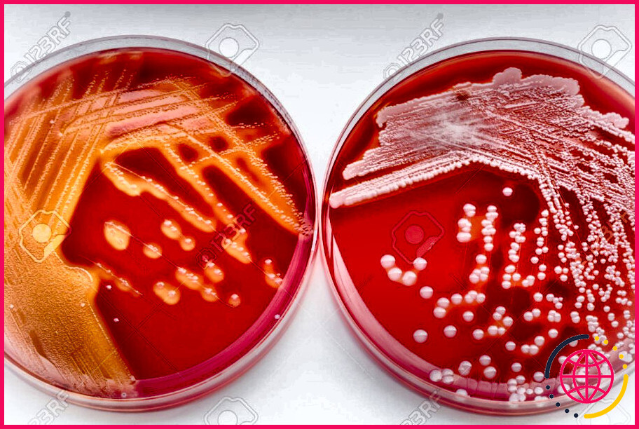 Streptococcus pyogenes est-il alpha-hémolytique ?
