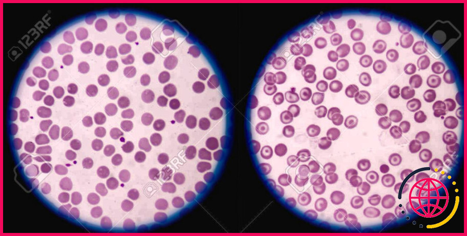 Les réticulocytes sont-ils des globules rouges nucléés ?