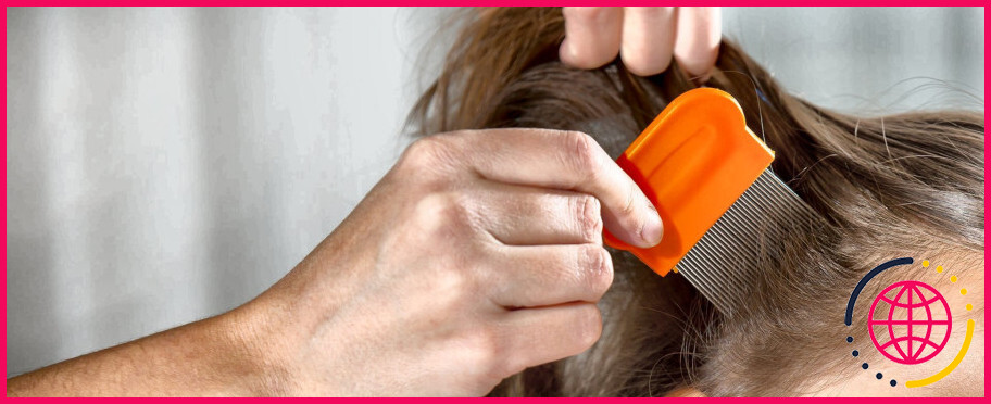 La lotion lindane peut-elle être utilisée sur les cheveux ?