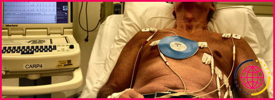 Combien de temps faut-il anticoaguler avant une cardioversion ?