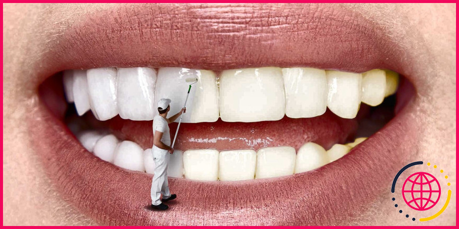 Comment se débarrasser des bactéries chromogènes sur les dents ?