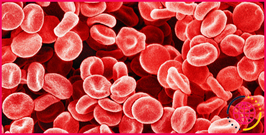 La thalassémie est-elle un cancer du sang ?