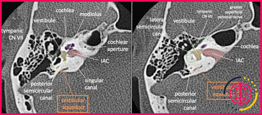 Quelle région de l'oreille abrite la périlymphe et l'endolymphe ?